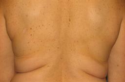 Back Lift Creates Smooth Lines Under Clothing before 1323546