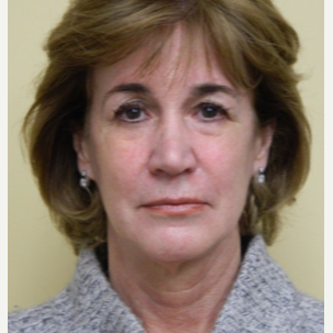 55-64 year old woman treated with Mini Lift, Browlift and 4- Lid Blepharoplasty before 3264931