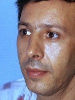 45-54 year old man treated with Rhinoplasty after 3104008