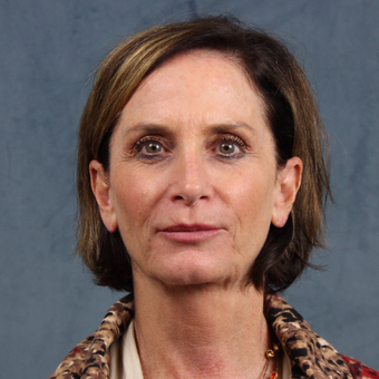 55-64 year old woman treated with Facelift Revision before 2723751