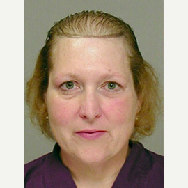 Hair Transplant before 3241490
