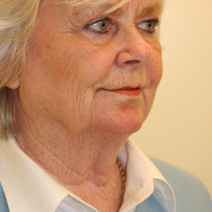 65-74 year old woman treated with Neck Lift before 3555289