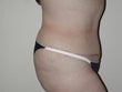 58 year old female patient 911395