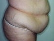 58 year old female patient 911395