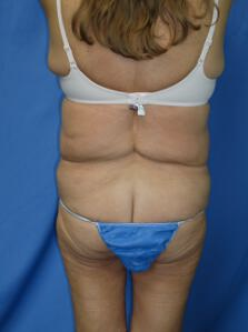 Circumferential Tuck 863778