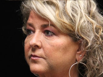 55-64 year old woman treated with Liquid Facelift 3502684