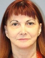 65-74 year old woman treated with Neck Lift after 3103868