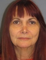 65-74 year old woman treated with Neck Lift before 3103868