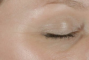 Botox before 989197