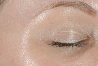 Botox after 989197