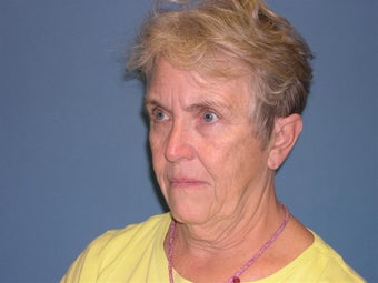 66 year old before 1072881