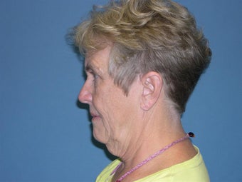 66 year old 1072881