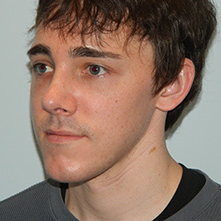25-34 year old man treated with Rhinoplasty after 3505972