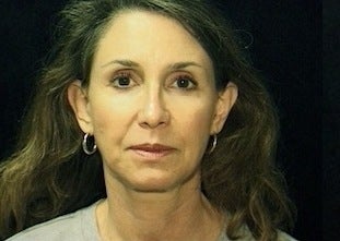Facelift before 1090671