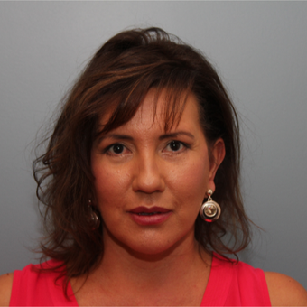 49 year old woman treated with Eye Bags Treatment after 3408310
