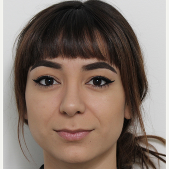 18-24 year old woman treated with Rhinoplasty after 3372944
