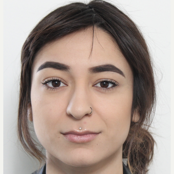18-24 year old woman treated with Rhinoplasty before 3372944