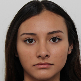 17 or under year old woman treated with Rhinoplasty after 3418799
