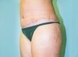 39 year old female patient 926805