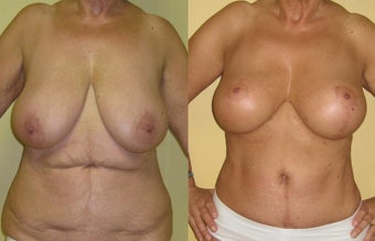 Grandmommy Makeover before 1437647