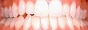 35-44 year old man treated for Braces after 1535140