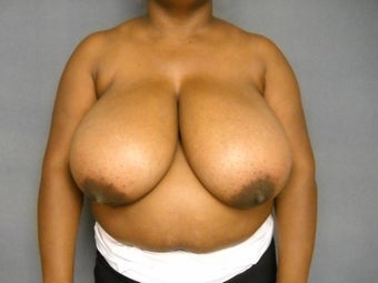 Age: 49, Height: 5"2", Weight: 199lbs. before 1124557