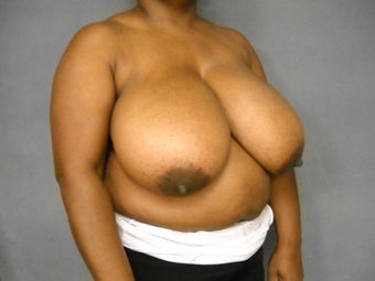 Age: 49, Height: 5"2", Weight: 199lbs. 1124557