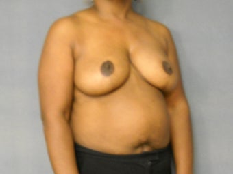 Age: 49, Height: 5"2", Weight: 199lbs. 1124557