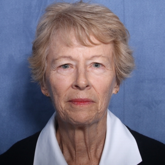65-74 year old woman treated with Neck Lift (view 1 of 2) before 3179870