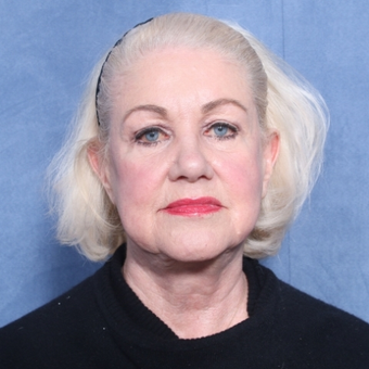 65-74 year old woman treated with Neck Lift (view 1 of 2) before 3175473