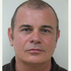 35-44 year old man treated with Laser Liposuction/Smartlipo for the jowls and lower jawline after 3243255