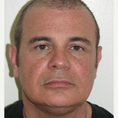 35-44 year old man treated with Laser Liposuction/Smartlipo for the jowls and lower jawline before 3243255