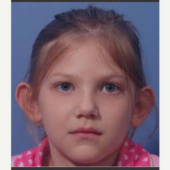 17 or under year old woman treated with Ear Surgery before 3711717