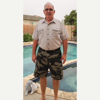 64 year old man treated with Sleeve Gastrectomy after 2661514