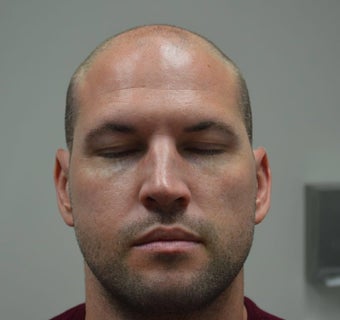 35-44 year old man treated with FUE Hair Transplant before 3065687