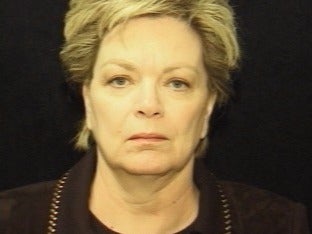 55-64 year old woman treated with Facelift and quad blepharoplasty before 2509037