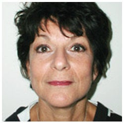Upper and lower eyelids / face and neck lift and brow lift. 334397