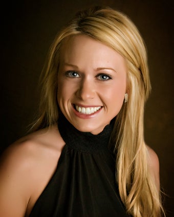 Veneers after 362779