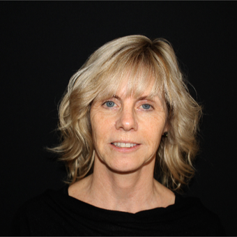 55-64 year old woman treated with Facelift before 3498818