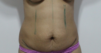 37 years old mother of two 1450899