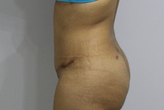 37 years old mother of two after 1450899