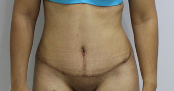 37 years old mother of two 1450899