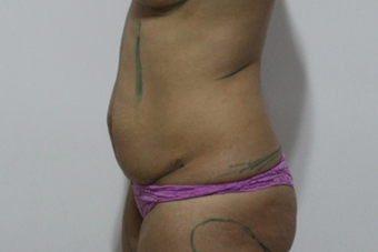 37 years old mother of two before 1450899