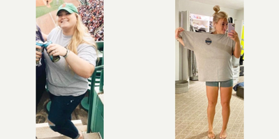 18-24 year old woman treated with Gastric Bypass - Being happy achieving her dream