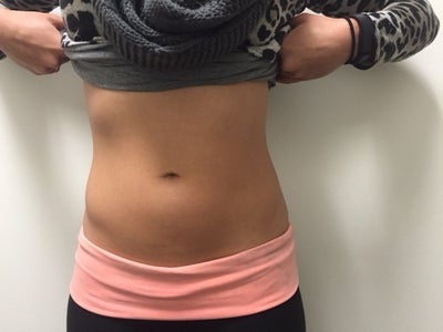 25 Year Old Active/fit Female, with Belly Pooch - Seattle, WA