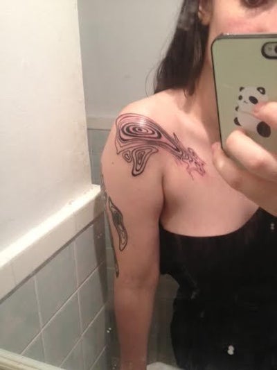 Dense black tattoo with raised lines - Will Picosure work ...
