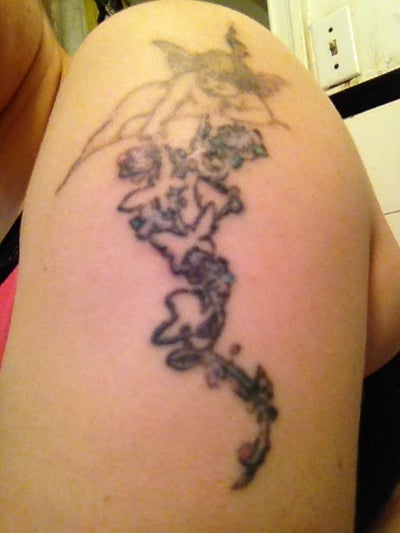 ... Impulsive Ink Choice in Toronto, ON - Tattoo Removal review - RealSelf