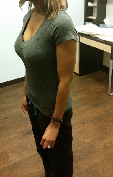 30 Years Old 5'3 110lbs, No Kids Allergan Natrelle Style 20 (High