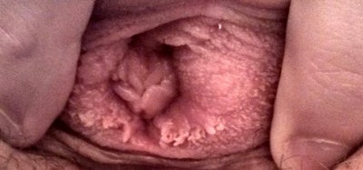 Consider, that cervix coming out of vagina read Cervix coming out of vagina consider, that