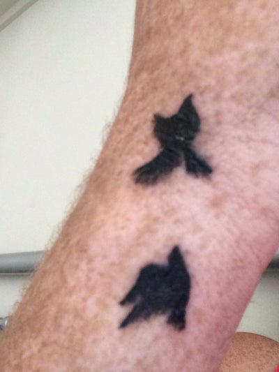 what is the best tattoo removal method for a week old what is the best tattoo removal method for a week old